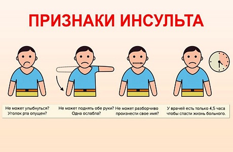 Спасите свою жизнь! Что нужно знать об инсульте